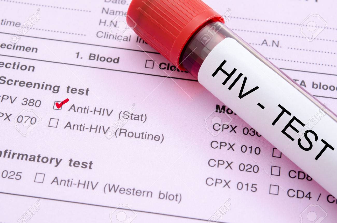 एचआईभी / एड्सबाट संक्रमित हुनेको संख्या तिव्र गतिमा बढ्दै