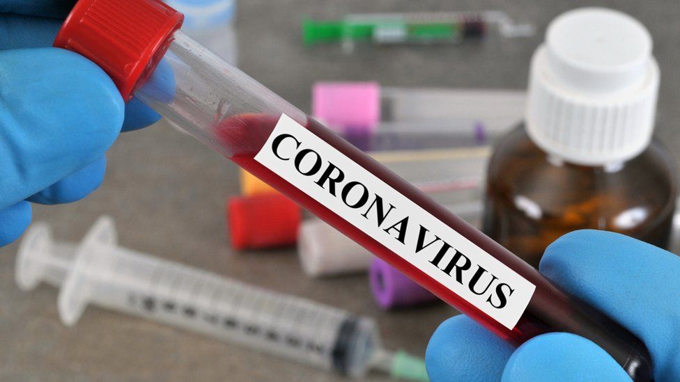 नेपालमा १५० जनामा कोरोना भाइरस संक्रमणको पुस्टि